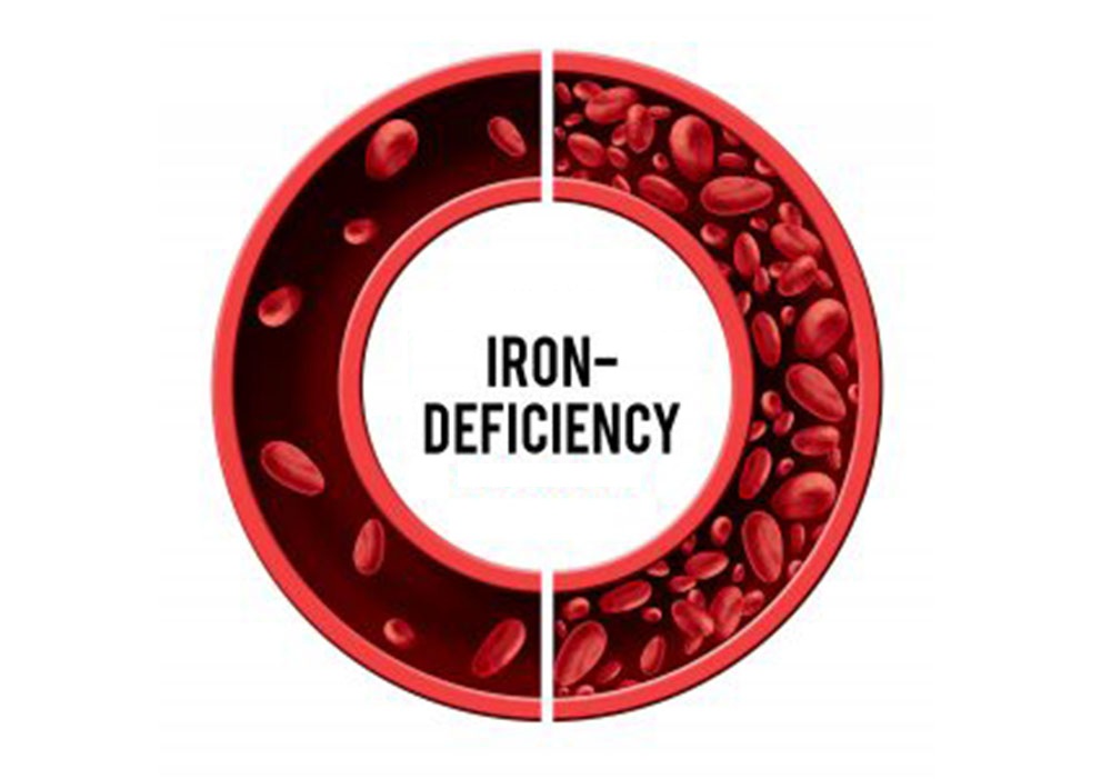 Iron Deficiency Profile