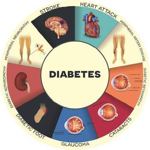 Advance Diabetic screening