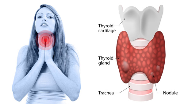 Thyroid Profile